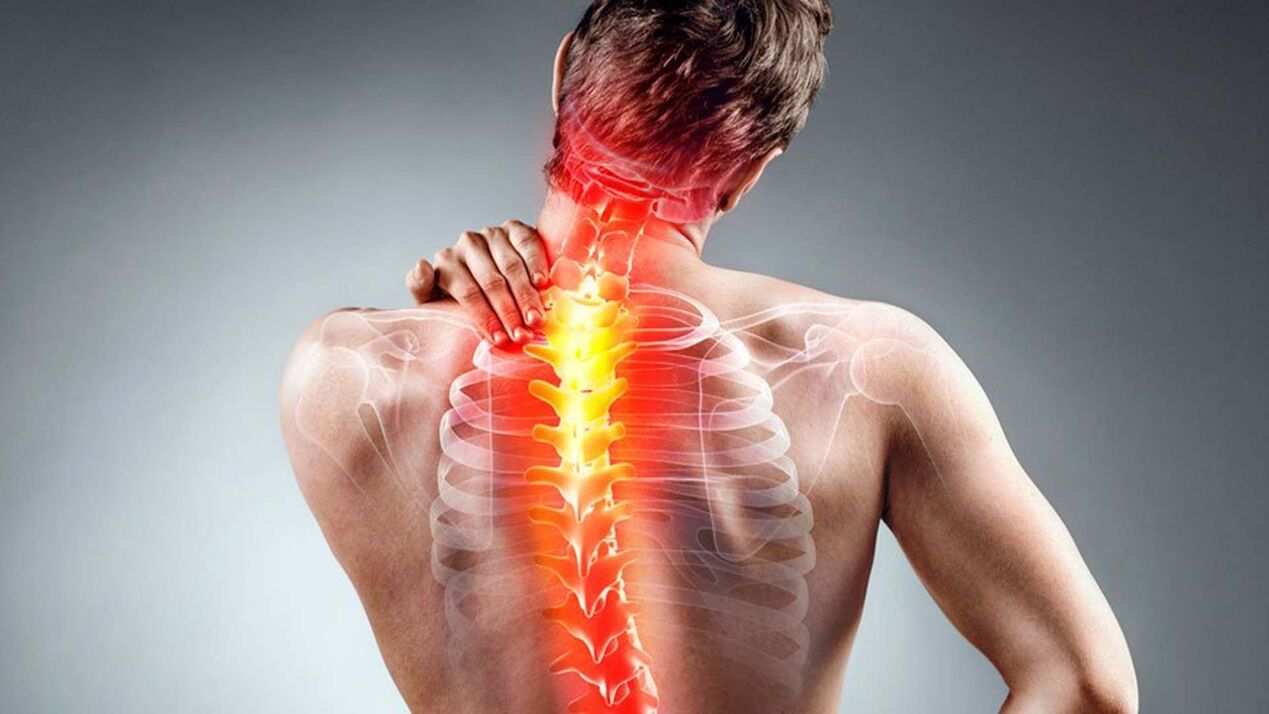 simptomi osteohondroze kralježnice